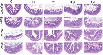 Radix paeoniae alba polysaccharide attenuates lipopolysaccharide-induced intestinal injury by regulating gut microbiota